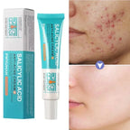 Salicylic Acid Acne Treatment Face Cream Repair Pimple Spots Deep Cleaning Pore Anti-acne Scar Oil Control Moisturizer Skin Care